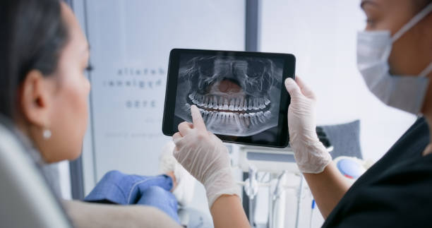 Licensed Root Canal Treatment service in Billington Heights, NY - Smile Center Dentistry